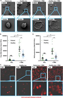 Neutrophils From Patients With Invasive Candidiasis Are Inhibited by Candida albicans Biofilms